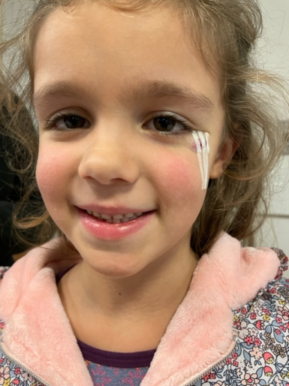 Young girl with facial stitches